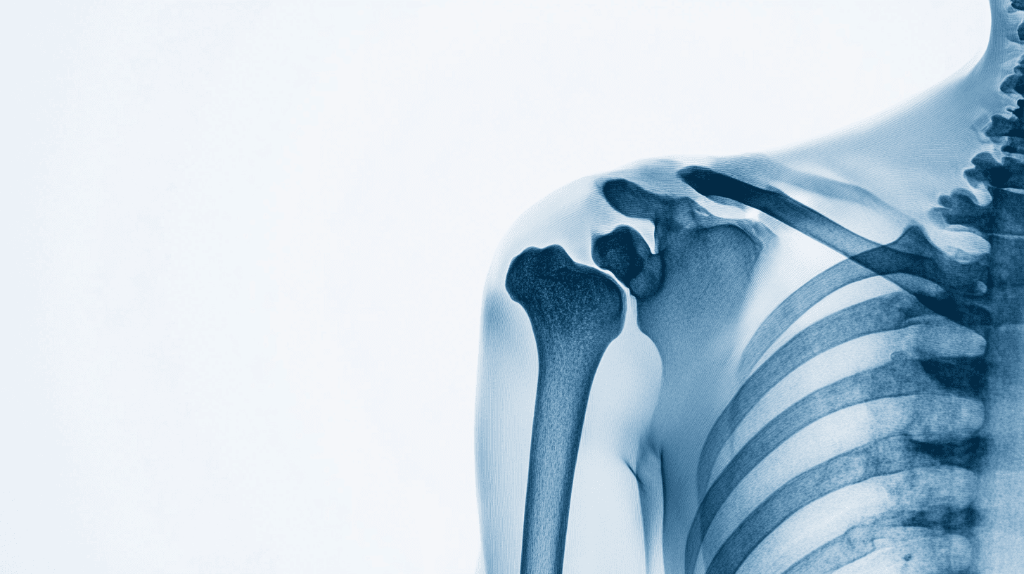 Wunden, Prellungen, Knochenbruch, HWS-Kopfverletzung, MTB-Erste-Hilfe-Bauchtrauma Wunden, Prellungen, Knochenbruch, HWS-Kopfverletzung, Bauchtrauma – was gibt es zu tun?